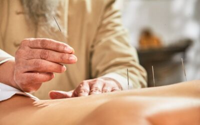 How to Choose Your Acupuncturist