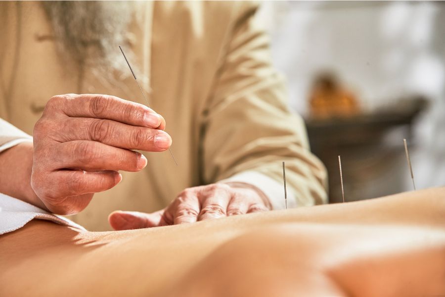 How to Choose Your Acupuncturist